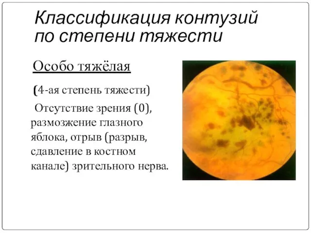 Классификация контузий по степени тяжести Особо тяжёлая (4-ая степень тяжести) Отсутствие