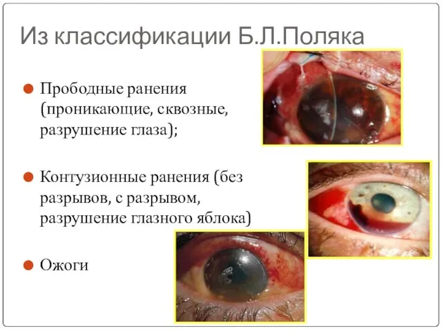 Из классификации Б.Л.Поляка Прободные ранения (проникающие, сквозные, разрушение глаза); Контузионные ранения