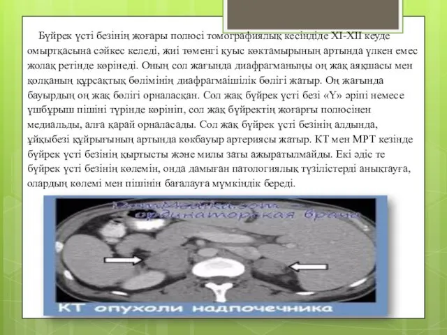 Бүйрек үсті безінің жоғары полюсі томографиялық кесіндіде XI-XII кеуде омыртқасына сәйкес