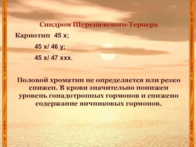 Синдром Шерешевского-Тернера Кариотип 45 х; 45 х/ 46 у; 45 х/