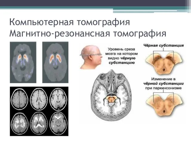 Компьютерная томография Магнитно-резонансная томография