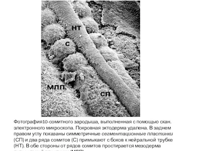 Фотография10-сомитного зародыша, выполненная с помощью скан. электронного микроскопа. Покровная эктодерма удалена.