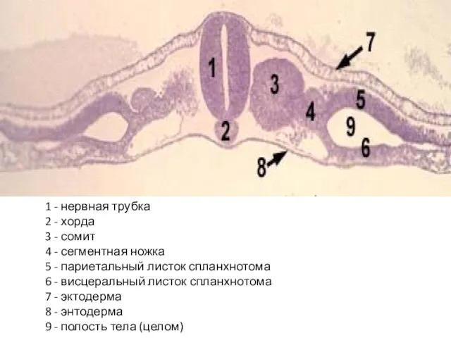 1 - нервная трубка 2 - хорда 3 - сомит 4