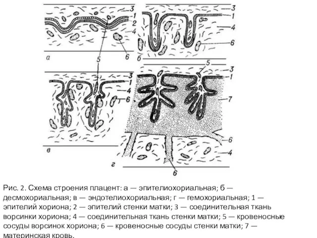 Рис. 2. Схема строения плацент: а — эпителиохориальная; б — десмохориальная;