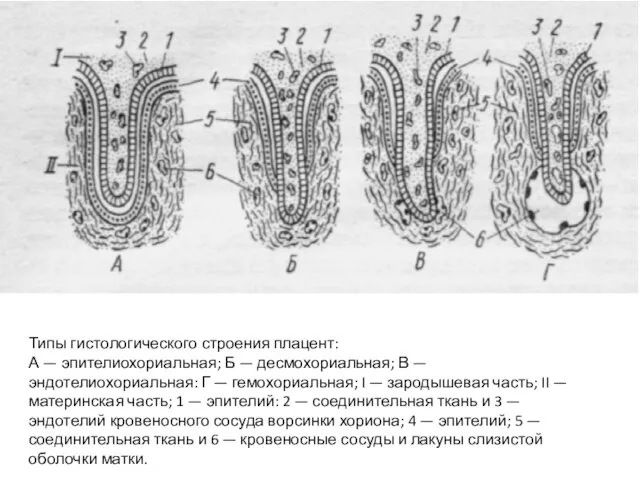 Типы гистологического строения плацент: А — эпителиохориальная; Б — десмохориальная; В