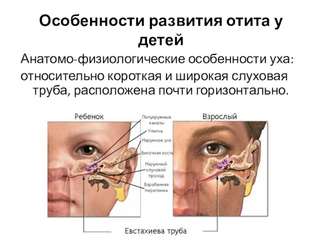 Особенности развития отита у детей Анатомо-физиологические особенности уха: относительно короткая и