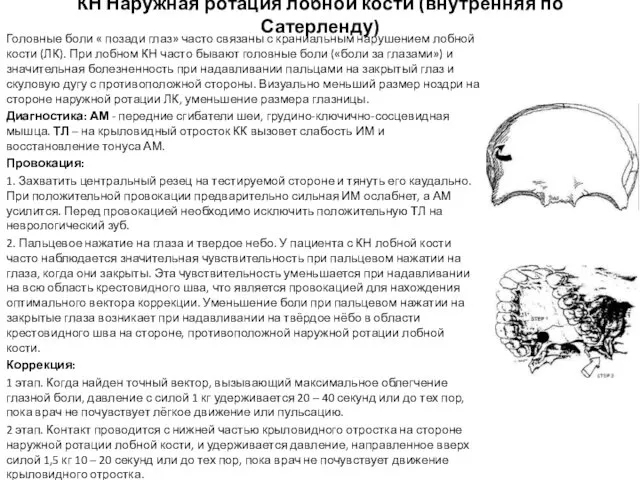 КН Наружная ротация лобной кости (внутренняя по Сатерленду) Головные боли «