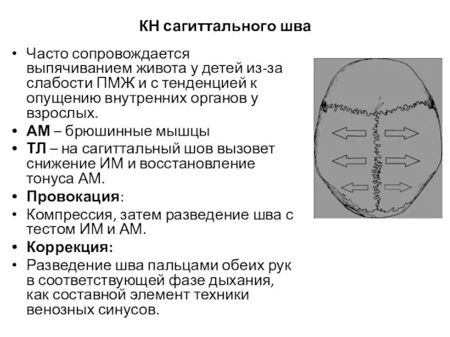 КН сагиттального шва Часто сопровождается выпячиванием живота у детей из-за слабости