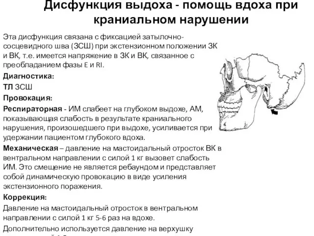 Дисфункция выдоха - помощь вдоха при краниальном нарушении Эта дисфункция связана