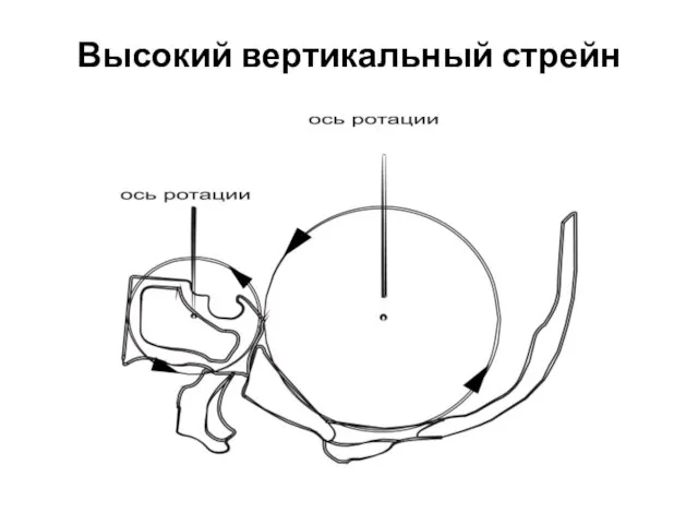 Высокий вертикальный стрейн