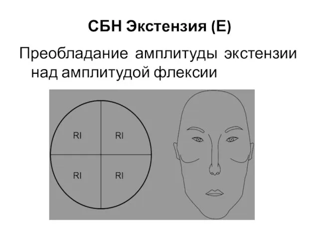 Преобладание амплитуды экстензии над амплитудой флексии СБН Экстензия (Е)