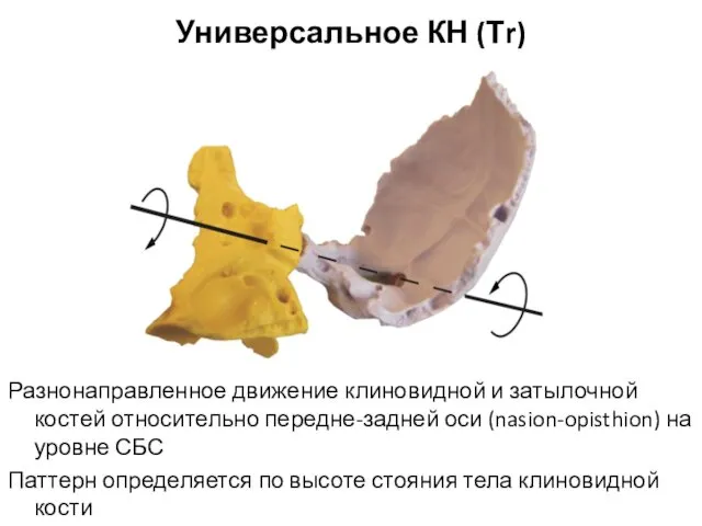 Разнонаправленное движение клиновидной и затылочной костей относительно передне-задней оси (nasion-opisthion) на