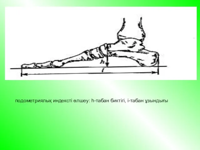 подометриялық индексті өлшеу: h-табан биктігі, і-табан ұзындығы