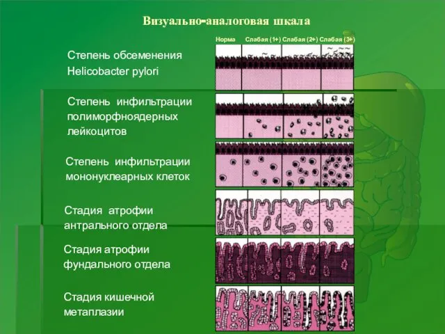 Визуально-аналоговая шкала Норма Слабая (1+) Слабая (2+) Слабая (3+) Степень обсеменения