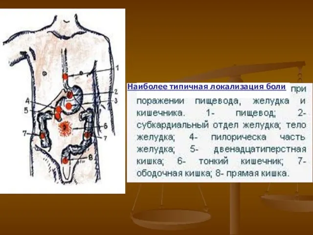 Л Наиболее типичная локализация боли