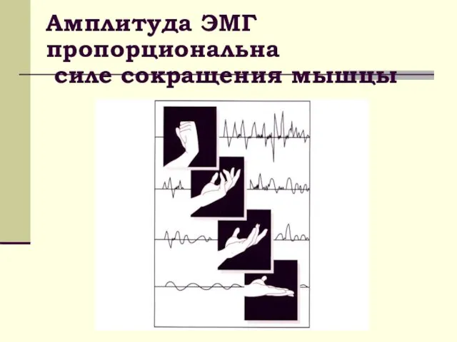 Амплитуда ЭМГ пропорциональна силе сокращения мышцы