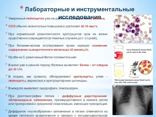 Лабораторные и инструментальные исследования Умеренный лейкоцитоз уже на ранних стадиях болезни,