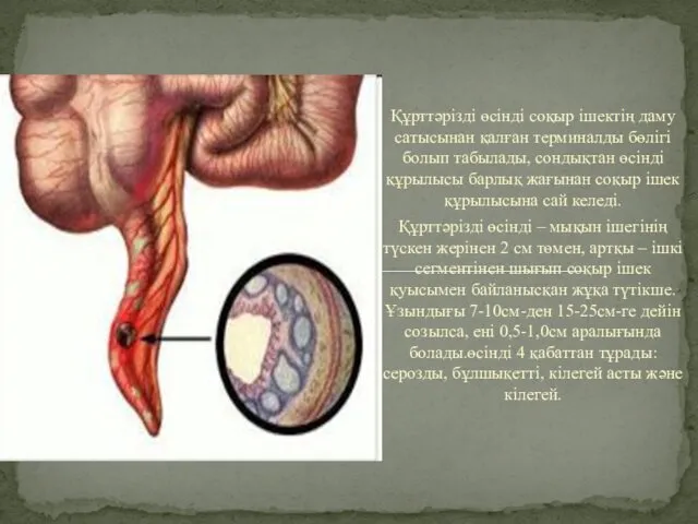 Құрттәрізді өсінді соқыр ішектің даму сатысынан қалған терминалды бөлігі болып табылады,