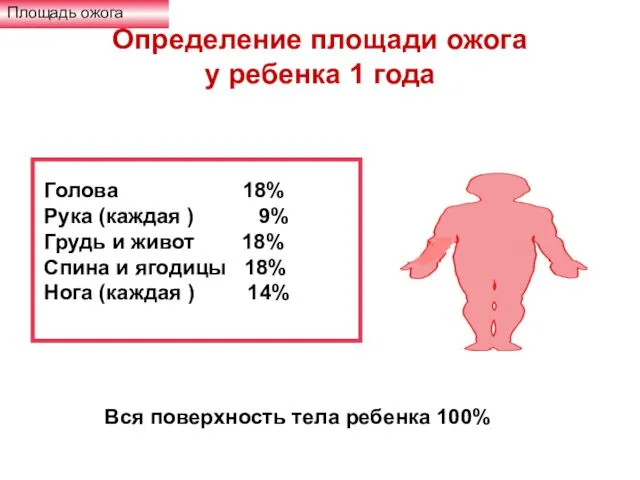 Определение площади ожога у ребенка 1 года Площадь ожога Голова 18%