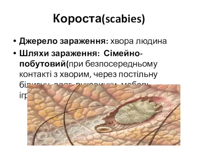 Короста(scabies) Джерело зараження: хвора людина Шляхи зараження: Сімейно-побутовий(при безпосередньому контакті з