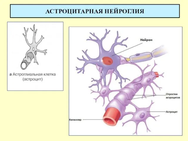 АСТРОЦИТАРНАЯ НЕЙРОГЛИЯ