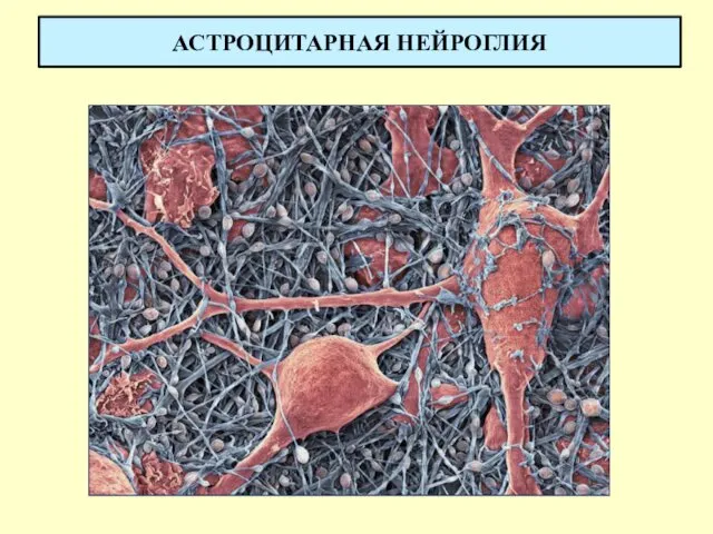 АСТРОЦИТАРНАЯ НЕЙРОГЛИЯ