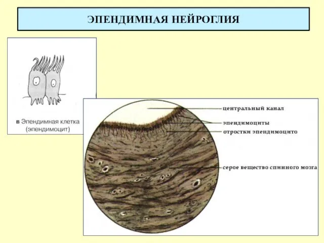 ЭПЕНДИМНАЯ НЕЙРОГЛИЯ