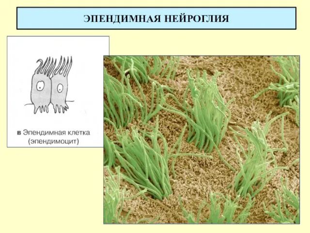 ЭПЕНДИМНАЯ НЕЙРОГЛИЯ