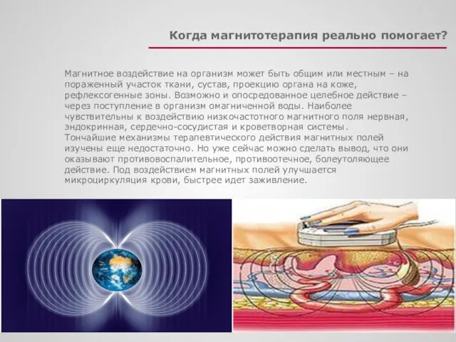 Когда магнитотерапия реально помогает? Магнитное воздействие на организм может быть общим