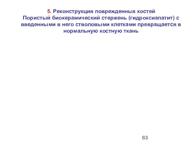 5. Реконструкция поврежденных костей Пористый биокерамический стержень (гидроксиапатит) с введенными в