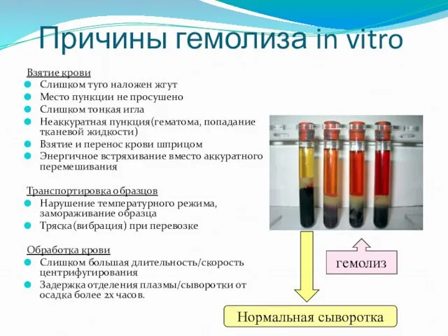 Причины гемолиза in vitro Взятие крови Слишком туго наложен жгут Место