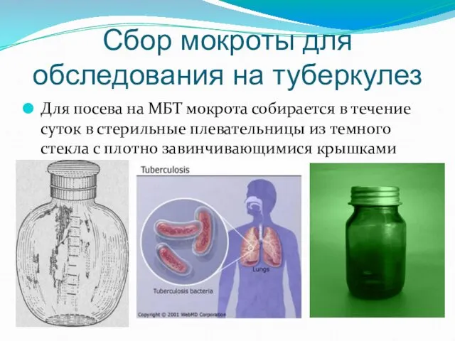 Сбор мокроты для обследования на туберкулез Для посева на МБТ мокрота