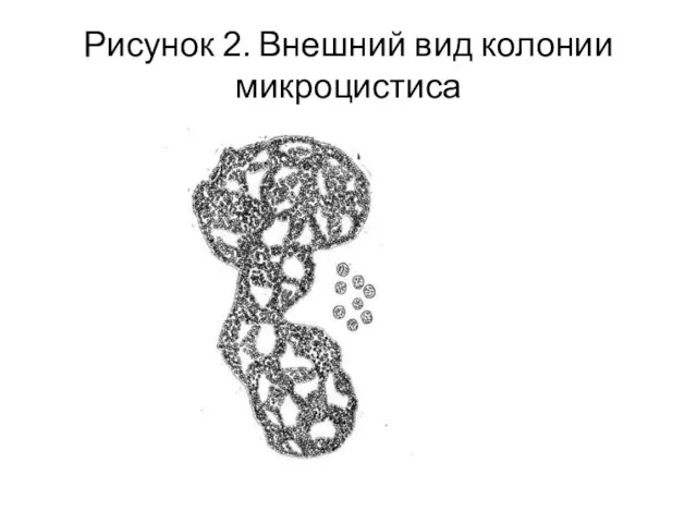 Рисунок 2. Внешний вид колонии микроцистиса