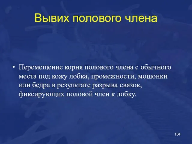 Вывих полового члена Перемещение корня полового члена с обычного места под