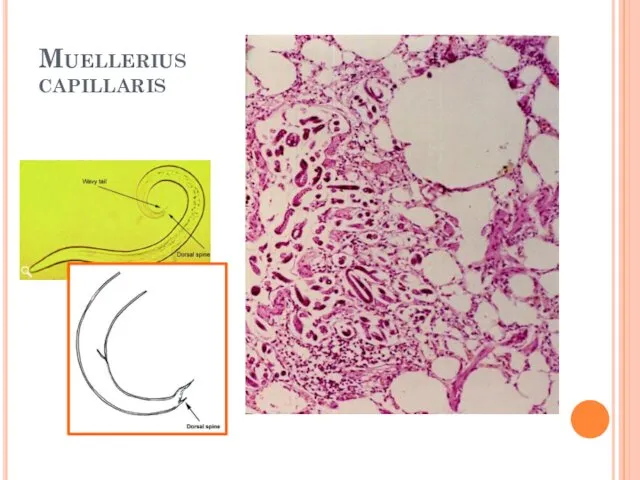 Muellerius capillaris