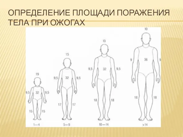 ОПРЕДЕЛЕНИЕ ПЛОЩАДИ ПОРАЖЕНИЯ ТЕЛА ПРИ ОЖОГАХ