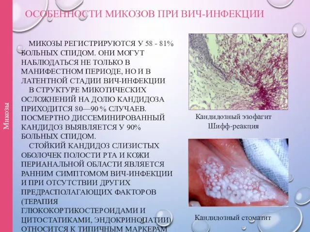 ОСОБЕННОСТИ МИКОЗОВ ПРИ ВИЧ-ИНФЕКЦИИ МИКОЗЫ РЕГИСТРИРУЮТСЯ У 58 - 81% БОЛЬНЫХ