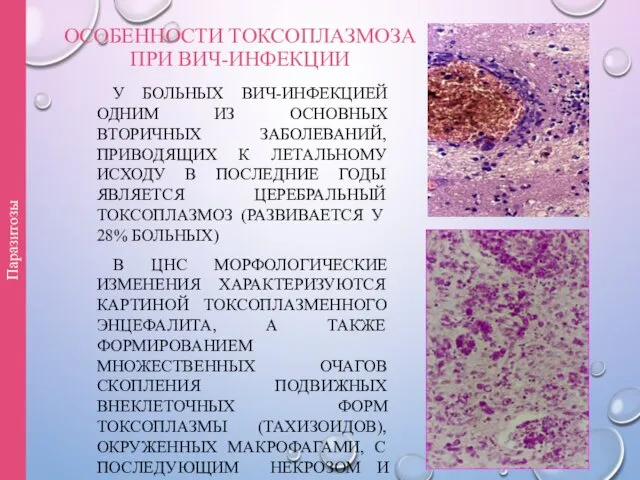 ОСОБЕННОСТИ ТОКСОПЛАЗМОЗА ПРИ ВИЧ-ИНФЕКЦИИ У БОЛЬНЫХ ВИЧ-ИНФЕКЦИЕЙ ОДНИМ ИЗ ОСНОВНЫХ ВТОРИЧНЫХ