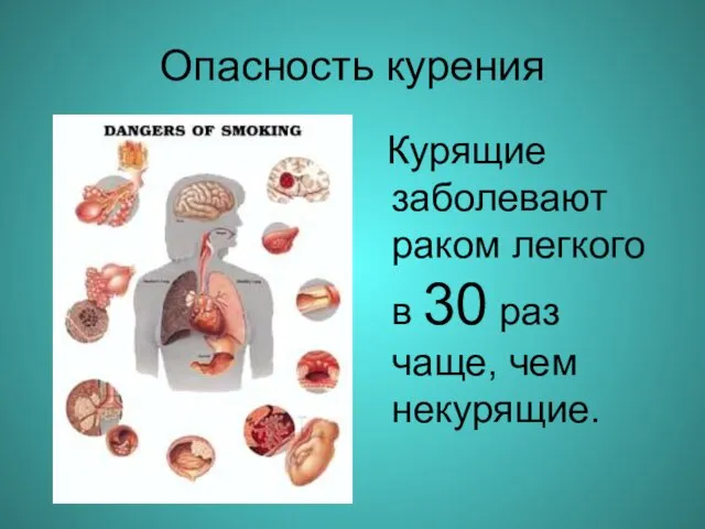 Опасность курения Курящие заболевают раком легкого в 30 раз чаще, чем некурящие.