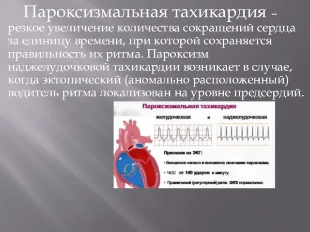 Пароксизмальная тахикардия – резкое увеличение количества сокращений сердца за единицу времени,