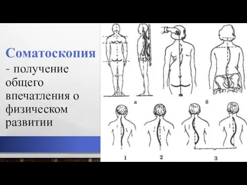 Соматоскопия - получение общего впечатления о физическом развитии