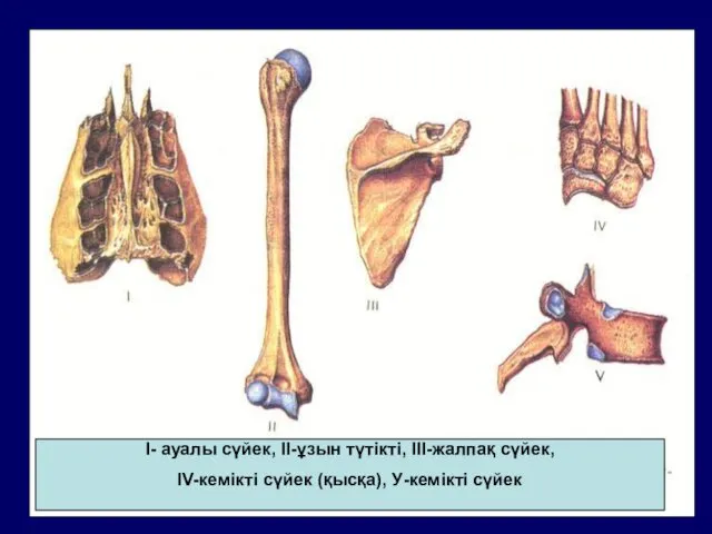 І- ауалы сүйек, ІІ-ұзын түтікті, ІІІ-жалпақ сүйек, ІV-кемікті сүйек (қысқа), У-кемікті сүйек