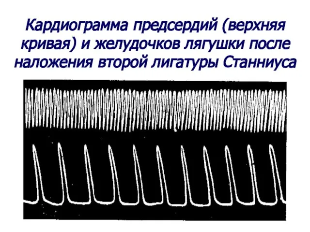 Кардиограмма предсердий (верхняя кривая) и желудочков лягушки после наложения второй лигатуры Станниуса