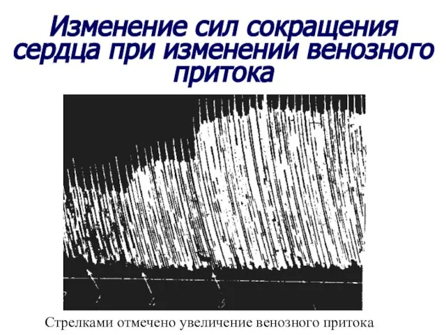 Изменение сил сокращения сердца при изменении венозного притока Стрелками отмечено увеличение венозного притока