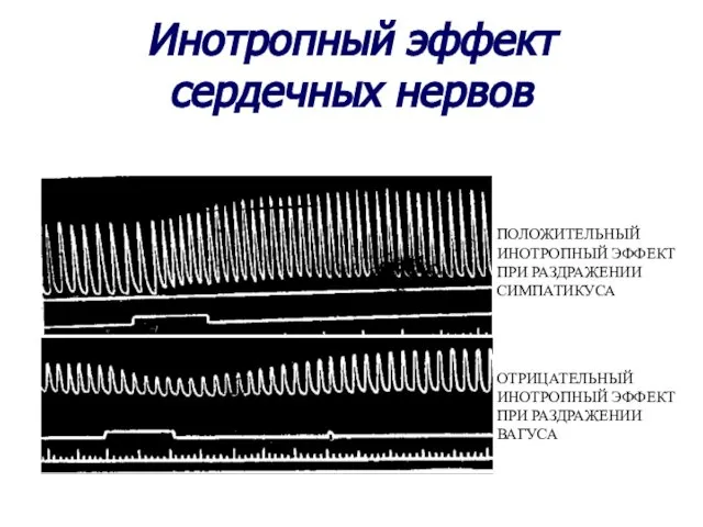 Инотропный эффект сердечных нервов ПОЛОЖИТЕЛЬНЫЙ ИНОТРОПНЫЙ ЭФФЕКТ ПРИ РАЗДРАЖЕНИИ СИМПАТИКУСА ОТРИЦАТЕЛЬНЫЙ ИНОТРОПНЫЙ ЭФФЕКТ ПРИ РАЗДРАЖЕНИИ ВАГУСА