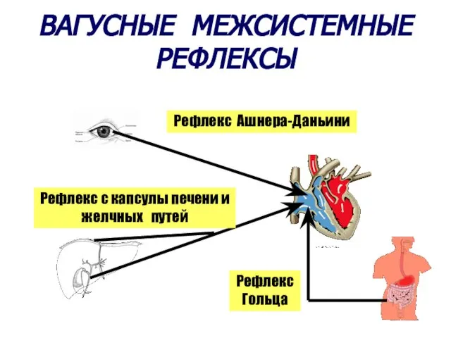 ВАГУСНЫЕ МЕЖСИСТЕМНЫЕ РЕФЛЕКСЫ Рефлекс Ашнера-Даньини Рефлекс с капсулы печени и желчных путей Рефлекс Гольца