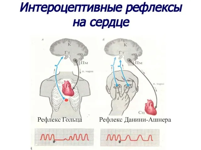 Интероцептивные рефлексы на сердце Рефлекс Гольца Рефлекс Данини-Ашнера
