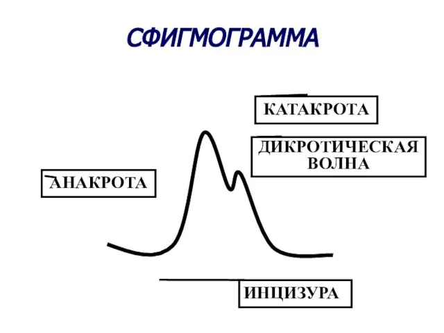 СФИГМОГРАММА АНАКРОТА КАТАКРОТА ДИКРОТИЧЕСКАЯ ВОЛНА ИНЦИЗУРА