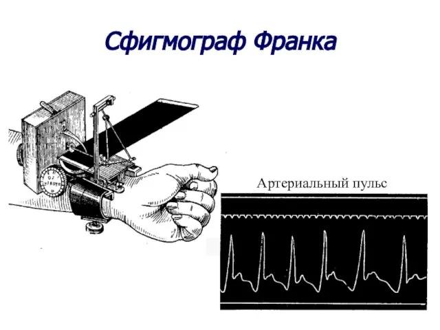 Сфигмограф Франка Сфигмограмма артериального пульса Артериальный пульс