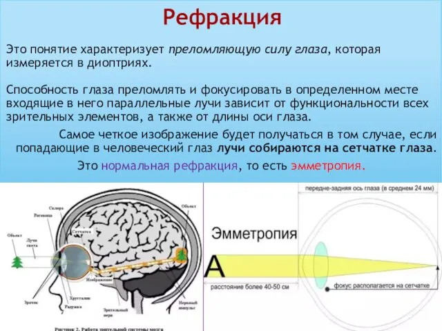 Это понятие характеризует преломляющую силу глаза, которая измеряется в диоптриях. Способность